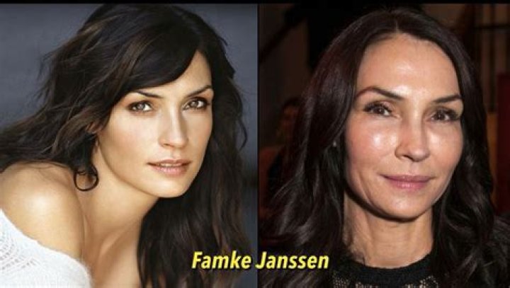 Famke Janssen Plastic Surgery Before and After Botox Injections